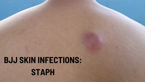 BJJ and Grappling Skin Infections Part 2: Staph and Impetigo